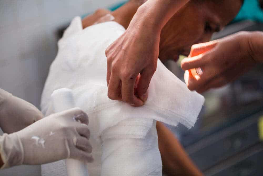 Burn Injury Lawsuit